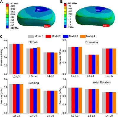 Effect of graded posterior element and ligament removal on annulus stress and segmental stability in lumbar spine stenosis: a finite element analysis study